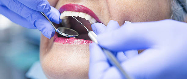 Best Emergency Dental Care for Abscessed Tooth in East Camden, SC